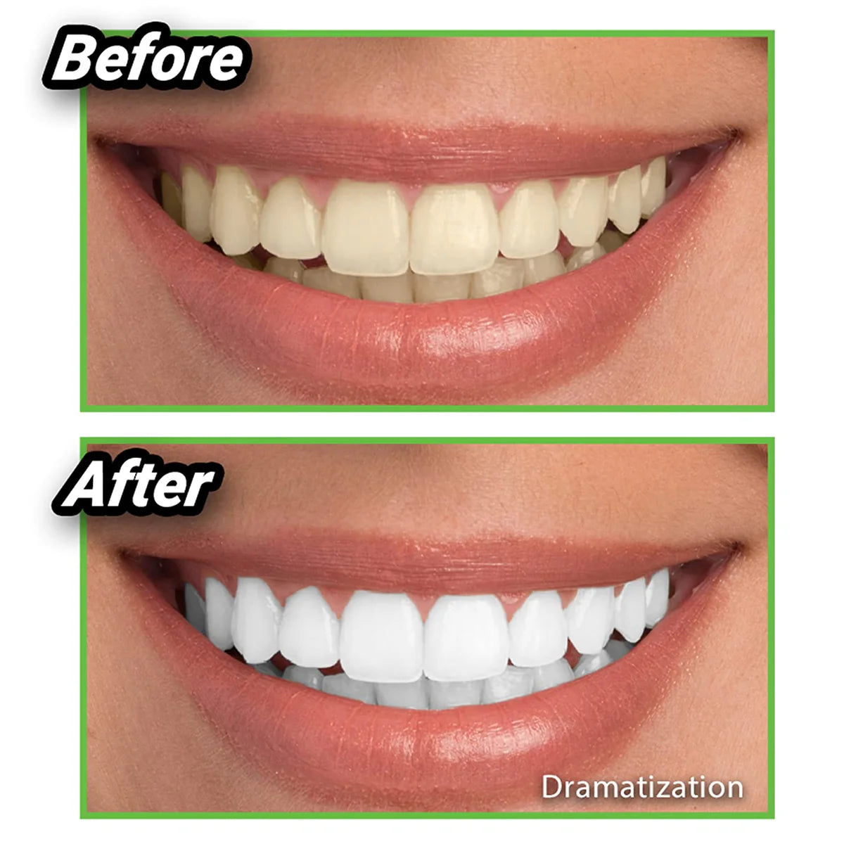 ¿Cansado de dientes manchados? Descubre el secreto natural para una sonrisa radiante. Blanqueador de dientes