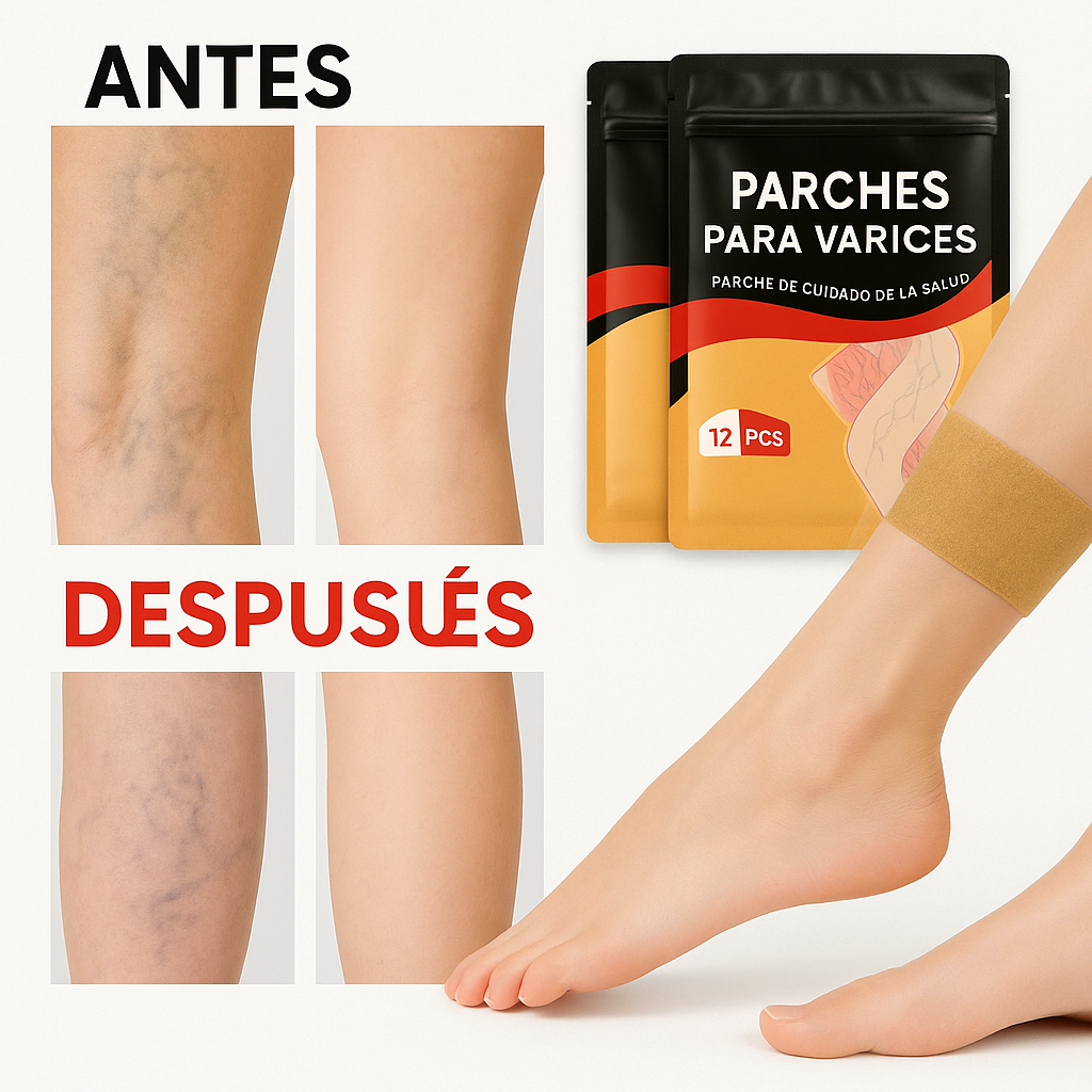 ¡Despídete de las várices SIN cirugía! 🔥  PARCHES PARA VARICES 3x1