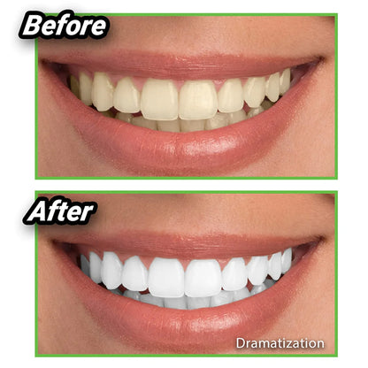 ¿Cansado de dientes manchados? Descubre el secreto natural para una sonrisa radiante. Blanqueador de dientes